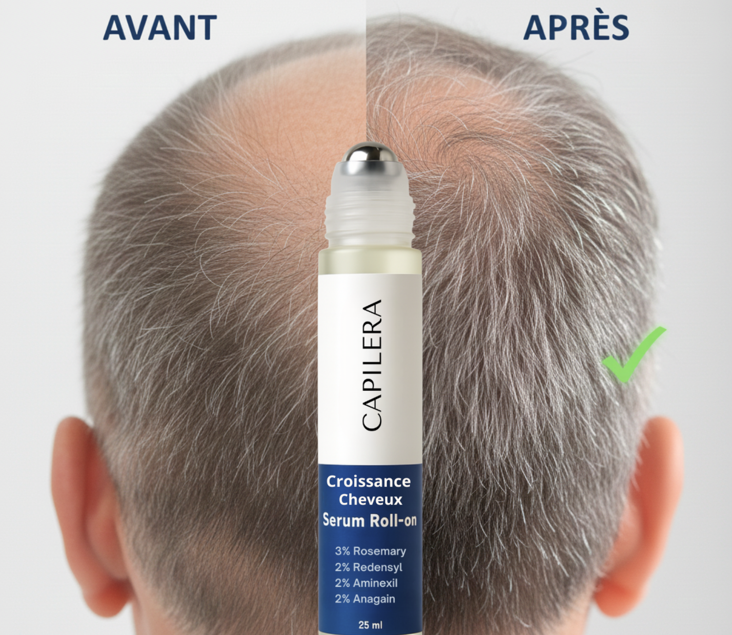 Roll-One Croissance Pro